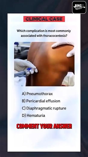 JINC Nursing Officer Coaching Jodhpur on Instagram: "Which Complication With Thoracocentesis..... Comment your answer . . . . . . #shorts #youtube #viral #status #shorts #jincenursing #nursingvideos #education #nursingexampreparation #nursingexam #reelsdaily #medico #aiims #success #instagram #reels #jodhpur #nursing #doctor #studentnurse #video #trendingreels❤#StudentLife #Motivation #सरकारी_नौकरी #StudyHard #JobForGraduate #GovtJobIndia #nursing_student"
