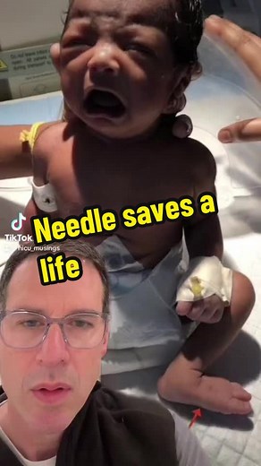 It takes a steady hand and berves of steel to fix this issue with a needle‼️ #obgyn #pediatrics #doctorsoftiktok #nursesoftiktok #healthcare #newborn Https://pubmed.ncbi.nlm.gov/37248030