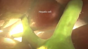 Medical Animation Microanatomy Hepatic Stellate Cell