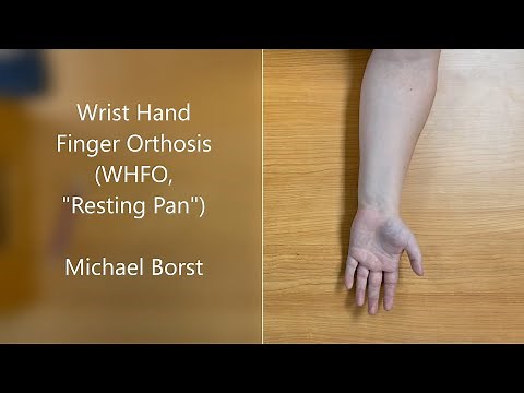 Volar Wrist Hand Finger Orthosis (WHFO) Fabrication