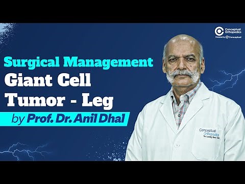 Surgical Management Giant Cell Tumor - Leg By Prof. Dr. Anil Dhal