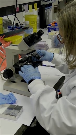 Researchers Identify Strategy To Slow Memory Loss In Alzheimer’s...