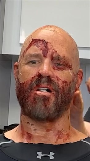 he looks like he just survived a bar fight with harcourt. | Peacemaker