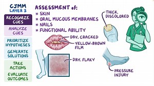 Video: Video Case Study - Integumentary System and Mucous Membranes - Video Explanation! | Osmosis | Osmosis