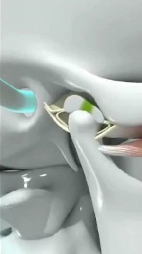 Is the #ringing In my ears #tinnitus or #tmj ?