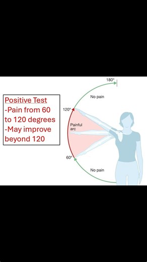 Painful Arc Test Explained 🦴 #shoulderpain #meded #medicaleducation #physiotherapy #atc #ortho