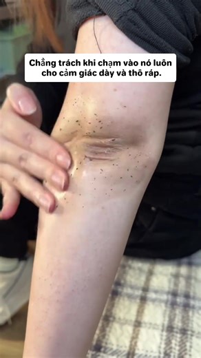 SHEEureka: Tẩy Tế Bào Chết An Toàn Cho Da Nhạy Cảm