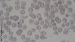 human blood cells under microscope for analysis or researching in laboratory Stock Video