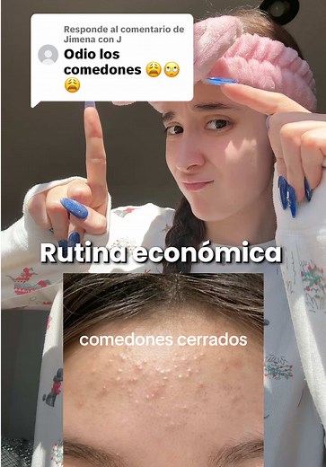 Rutina económica para eliminar comedones cerrados