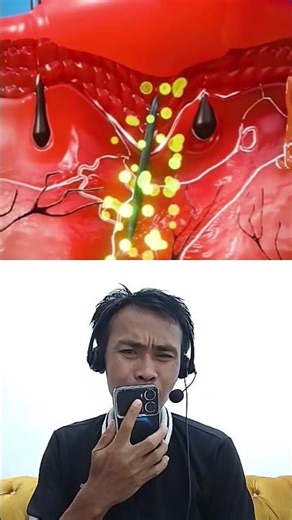 The Secret Behind Splinters🤔