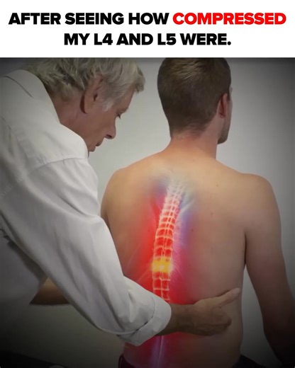 7.6K views · 27 reactions | ❗️Struggling with sciatica and lower back pain? A comprehensive solution designed to alleviate back pain and sciatica. It combines three unique products that work together to provide targeted relief and support. By using the Decompression Belt, Support Belt, and Pain Relief Patch in conjunction, individuals can experience a holistic approach to managing and treating their back pain and sciatica. | WellHealthis Store | Facebook