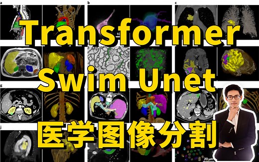 席卷CV界的Transformer到底有多牛！Swin-Unet：基于Transformer的医学图像分割实战，迪哥手把手带你精读论文并复现源码！
