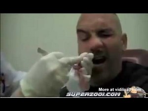 longest booger gets taken out