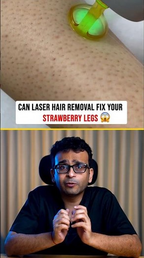 Can Laser Hair Removal Fix Strawberry Legs & Ingrown Hairs? | Dermatologist Explains