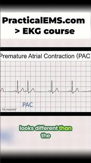 ECG Secrets: Spotting Irregularities and Subtle Signs of PAC! #shorts