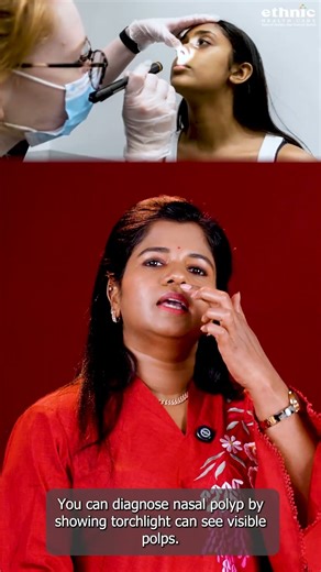 #nasalpolyps | Do this to dissolve the growth of flesh growing in the nose | Dr. B.Yoga Vidhya