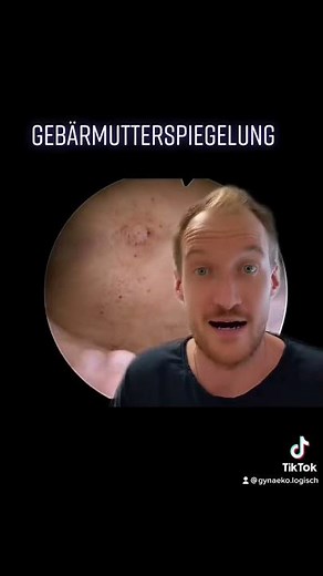 Hysteroscopy l This is what a uterus looks like from the inside l Gynecologist surgery I #shorts