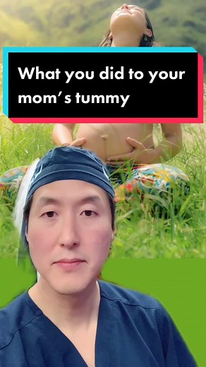 WTF did you do to your mom’s tummy? #surgery #tummytuck #plasticsurgeon #plasticsurgery #anatomy #doctor #mommymakeover