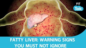 Fatty liver disease is becoming increasingly common, but many people don’t realize they have it until the condition progresses. In this video, we’ll help you understand what fatty liver disease is, what causes it, and how you can take steps to protect yourself. Fatty liver happens when excess fat builds up in the liver, and while it may not cause obvious symptoms at first, it can lead to serious health problems if left untreated. In this video, Sneha Mordani explains the early signs and symptoms