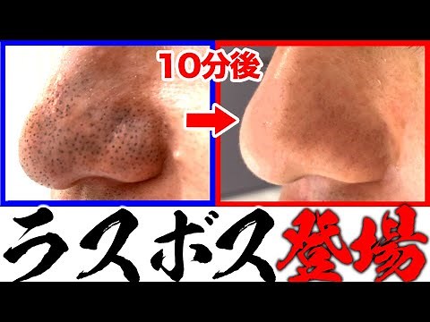 [Strawberry nose] We will seriously cure your dirty blackheads! We will thoroughly remove dirt fr...