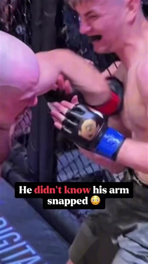 Fighter breaks arm in MMA match. #ufc_mma_sport #ufc #mma