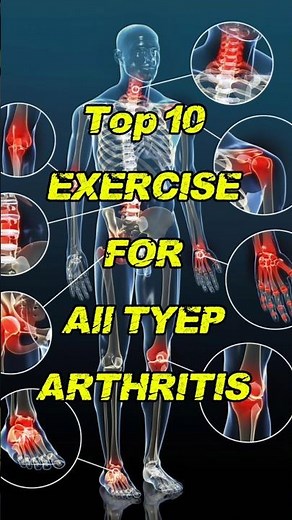 Top 10 Exercises for Arthritis Pain Relief (Easy Home Routine)