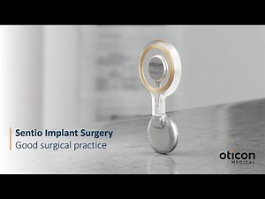 Sentio™ System: A Straightforward Active Transcutaneous Bone Conduction Procedure