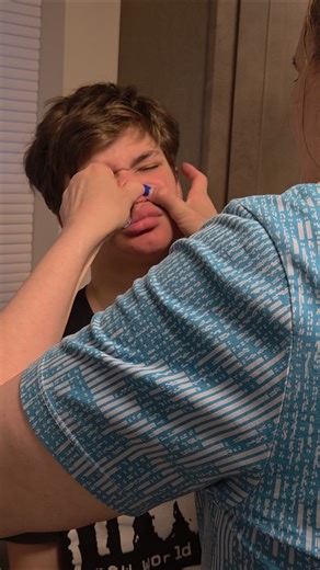 Nephew Meets Puberty. Getting Zits Popped 🤣. #Nephew #Puberty #SkinCare #Switch #Nintendo #BestLife