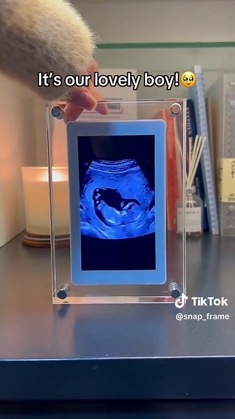 Emotional Baby Ultrasound Experience