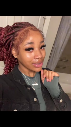 I’m always scratching up my face #fypシ゚viral | face