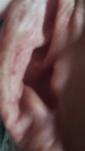 Regularly clean your ears while working from home and take care of your health. #nature1