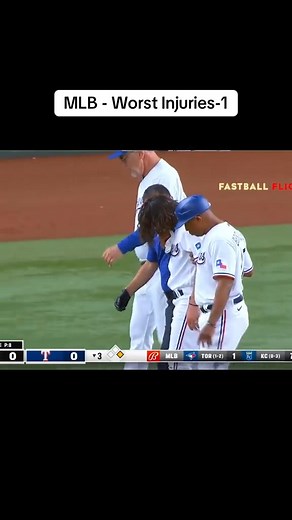 MLB - Worst Injuries-1 #MLBHistory #MLB #baseball Part 5 | Baseball blitz