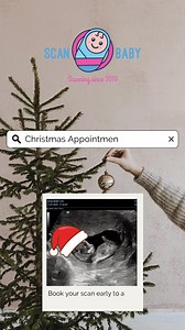 ✨ Christmas Magic Starts Here at Scan Baby Mansfield! ✨ December...
