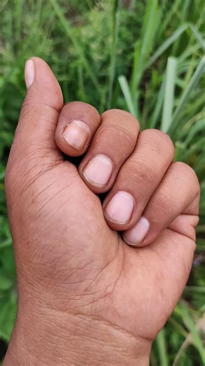 #anyuniqueanimals #beautifulinsects #wildlife #nature