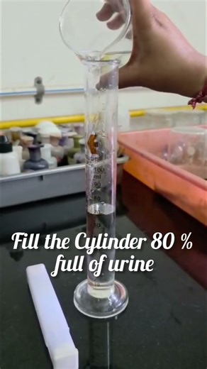 Urine analysis #specific gravity method #like #shorts #urinalysis#dailyvlog#shots#watch #students