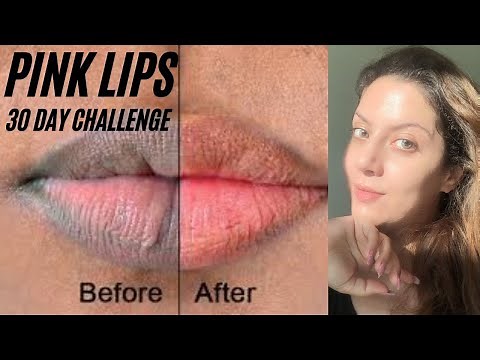 How to get pink lips naturally| Dark lip treatment | How lighten dark lips Hyperpigmentation on lips