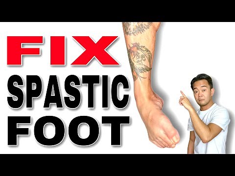 Fix a Spastic Foot Stretches and Exercises | Occupational Therapy
