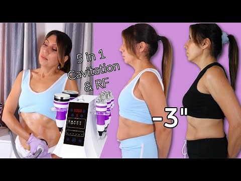 HONEST REVIEW* At home Claire 5 In 1 Cavitation Machine + Before And After Results | Surebeauty