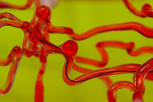 Robotic thread is designed to slip through the brain’s blood vessels