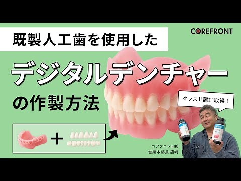 既製人工歯を使用したデジタルデンチャーの作製方法 exocad・3Dプリンター