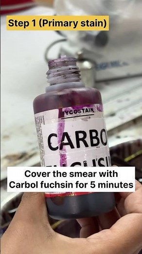 Ziehl Neelsen staining procedure 🦠| AFB | TB #znstaining #acidfastbacilli #tuberculosis #shorts