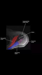 #MRI #anatomy #shoulder #CT #lesson | CT Scan and MRI study