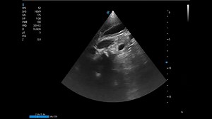 5.6K views · 98 reactions | A very simple way to differentiate...