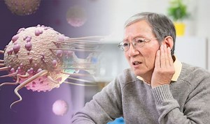 Cancer symptoms: Little known signs you could have head cancer