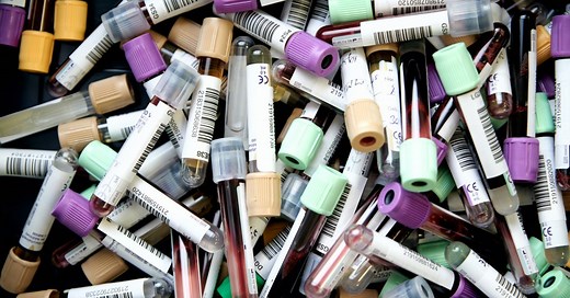 Leucopenia: causas, sintomas e como tratar a queda dos leucócitos