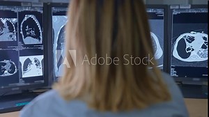 Doctor Looking at the Patient's Lung X-Ray Scan on the Monitors and Doing Test Results Analysis. Health Care Clinic Research Laboratory, Radiology, Radiologist Looking at MRI CT Scans, Lung Cancer