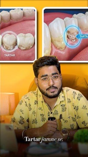 Dentist Reveals Gum Swelling Ka #1 REASON 😳 #gumswelling #gumcare #healthygums #shortsviral #short
