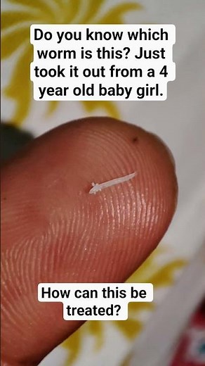 Is this the Pin worm? Or Not? How can this be treated? #wormworld #pinworm