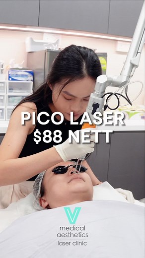 ✨ Unlock Your Skin’s Potential with Pico Laser – Just $88! #GlowGetter #SkinRenewal