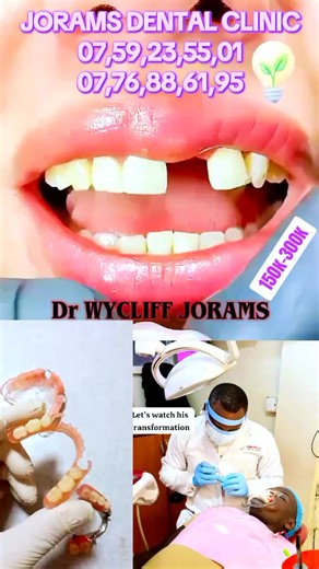 artificial teeth flexible dentures BEST #teeth #restoration #dentist #dental #dentistry